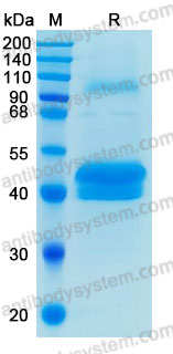 Recombinant Human PTX3 Protein, C-His (Active)