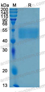 Recombinant Human CD123/IL3RA Protein, C-His (Active)