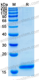 Recombinant Human CST5 Protein, C-His (Active)