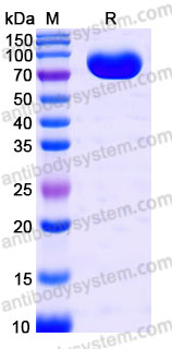 Biotinylated Human CD30/TNFRSF8 Protein, C-His-Avi