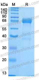 Recombinant Human EPHA3 Protein, C-His (Active)