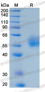 Recombinant Human SERPINB3/SCCA Protein, C-His (Active)