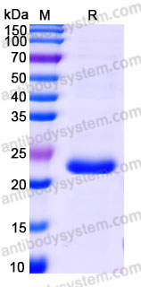 Biotinylated Human CD154/CD40LG/TNFSF5 Protein, N-His-Avi
