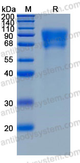 Recombinant Human CD6 Protein, C-His (Active)