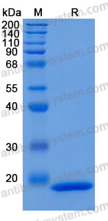 Recombinant Human LCN1 Protein, C-10*His (Active)