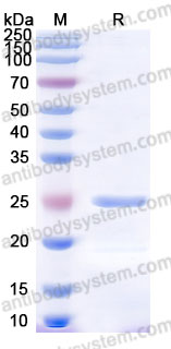 Recombinant Human FGF9 Protein, Tag free (Active)