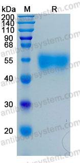 Recombinant Human CD132/IL2RG Protein, C-His (Active)