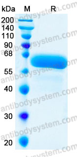 Recombinant Human CD131/CSF2RB Protein, C-His (Active)