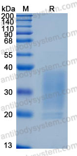Recombinant Human CD153/TNFSF8/CD30L Protein, N-His (Active)
