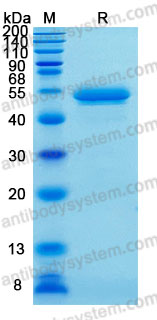 Recombinant Human SERPINF1/PEDF/Serpin F1 Protein, C-His (Active)
