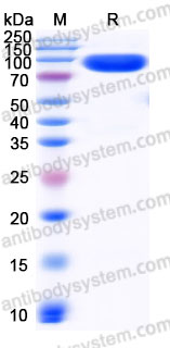 Recombinant Human THPO Protein, N-His & C-His (Active)