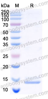 Recombinant Human IL15 Protein, Tag free (Active)