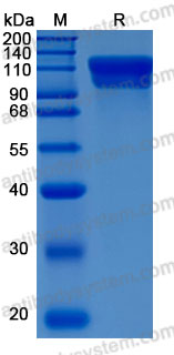 Recombinant Human ECE1 Protein, N-10*His (Active)