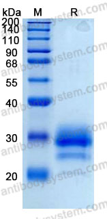 Recombinant Human TFPI2 Protein, C-10*His (Active)