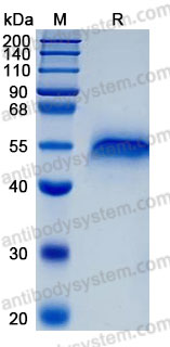 Recombinant Human CCN3 Protein, C-10*His (Active)