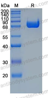 Recombinant Human CD239/BCAM Protein, C-His (Active)