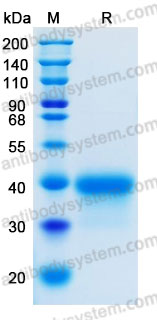 Recombinant Human EFNA3 Protein, C-His (Active)