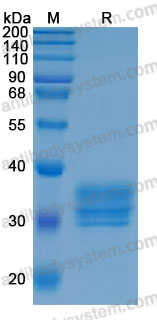 Recombinant Human STC1 Protein, C-His (Active)