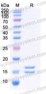 Recombinant Human IL2 Protein, C-His (Active)