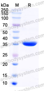 Recombinant Human NRG1/Neuregulin-1 Protein, Tag free (Active)
