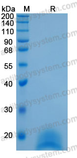 Recombinant Human TFF2 Protein, C-His (Active)