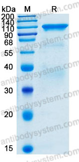 Recombinant Human HGFAC Protein, N-His (Active)