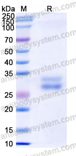 Biotinylated Human CD137/TNFRSF9/4-1BB Protein, C-Avi-His