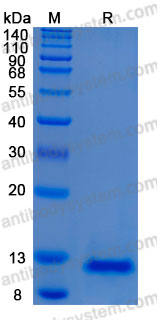 Recombinant Human TFF3 Protein, C-His (Active)