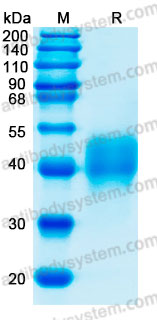 Recombinant Human CD300c Protein, C-His (Active)