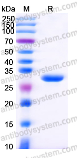 Recombinant Human CD161/KLRB1 Protein, C-His (Active)