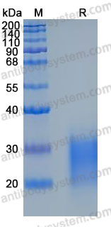 Recombinant Human CD94/KLRD1 Protein, N-His (Active)