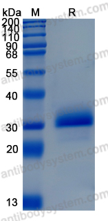 Recombinant Human NOG/Noggin Protein, C-His (Active)