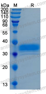 Recombinant Human BTN1A1 Protein, C-His (Active)