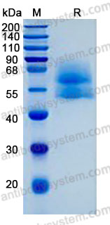 Recombinant Human TPBG/5T4 Protein, C-His (Active)