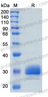 Recombinant Human EFNB3 Protein, C-His (Active)