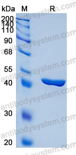 Recombinant Human CHI3L2 Protein, C-10*His (Active)