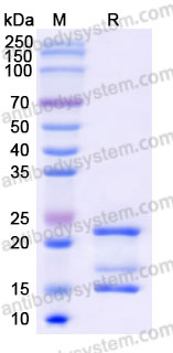 Biotinylated Human IL17A/F Protein, C-Avi-His