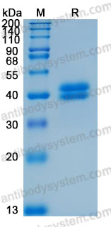 Recombinant Human PRSS8 Protein, C-10*His (Active)