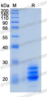 Recombinant Human MOG Protein, C-10*His (Active)