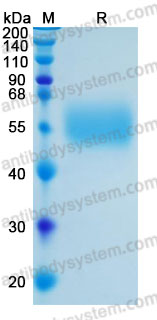 Recombinant Human MICA Protein, C-His (Active)