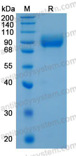 Recombinant Human VASN Protein, C-His (Active)