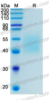 Recombinant Human VTCN1/B7-H4 Protein, C-His (Active)