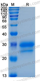 Recombinant Human IL29/IFNL1 Protein, C-His (Active)