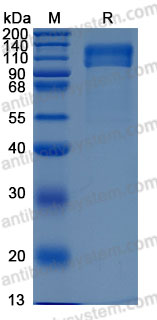 Recombinant Human IL17RC Protein, C-hFc-His (Active)