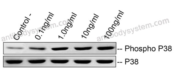 Recombinant Human FNDC5 Protein, C-His (Active)