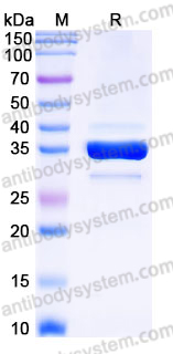 Recombinant Human CD85k/LILRB4/ILT3 Protein, C-His (Active)