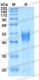 Recombinant Human IL22RA2/IL-22BP Protein, C-His (Active)