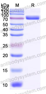 Recombinant Human IL22RA2 Protein, C-Fc (Active)