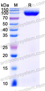 SDS-PAGE for Recombinant Human ACE2 Protein, C-mFc (Active) ?>
