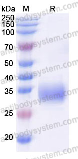 Biotinylated Human TREM2 Protein, C-Avi-His